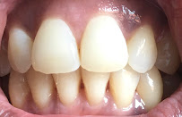 Family Orthodontics - Orthodontist Liverpool
