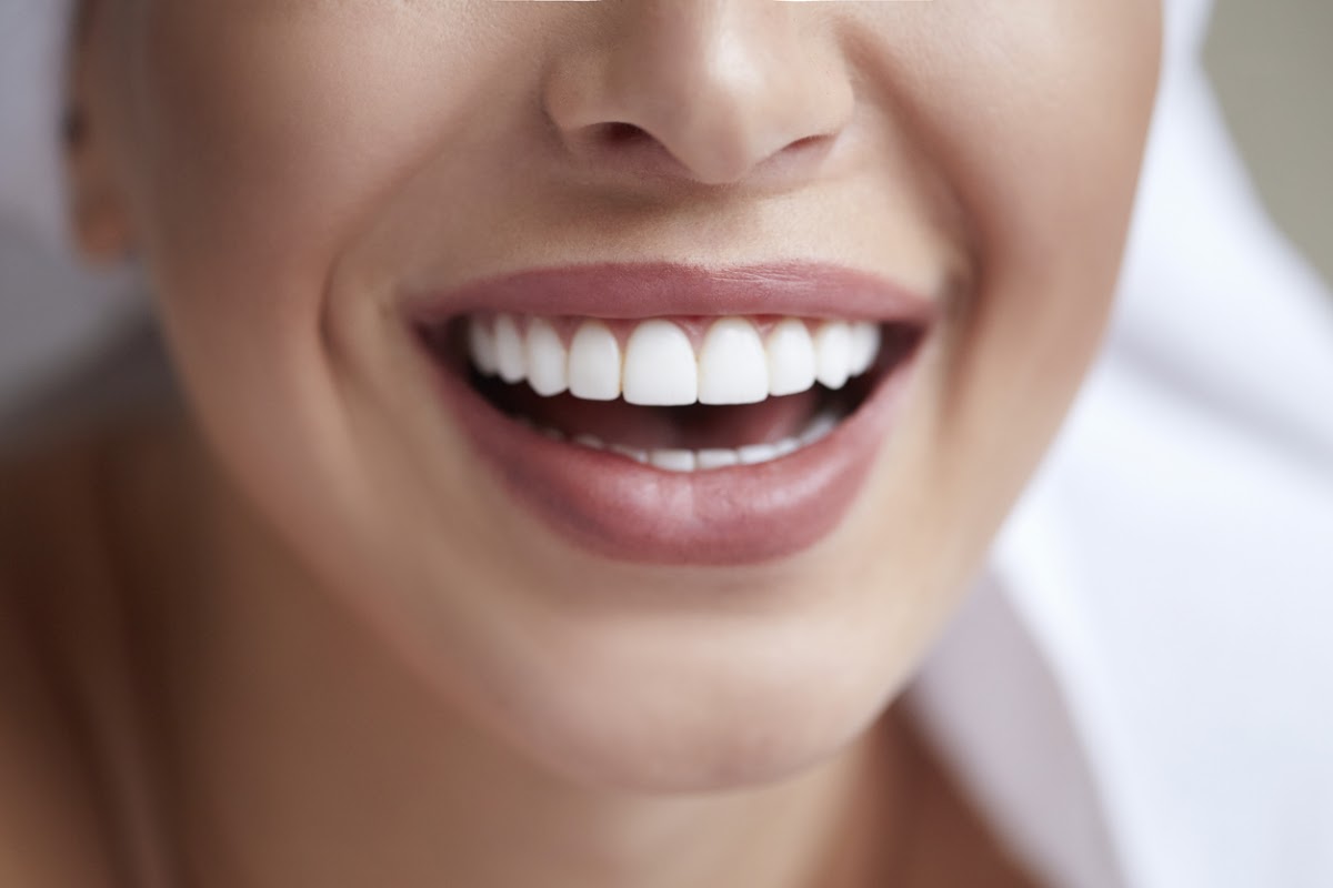 Verve Dental Melbourne