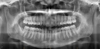 Melbourne Dental X-Ray