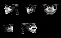 Melbourne Dental X-Ray