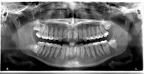 Melbourne Dental X-Ray