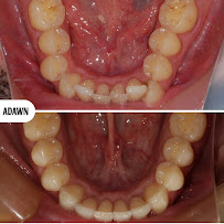 Adawn Dental Studio