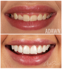 Adawn Dental Studio