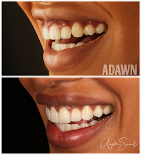 Adawn Dental Studio
