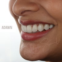 Adawn Dental Studio in Melbourne