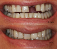 Melbourne Smile Clinic