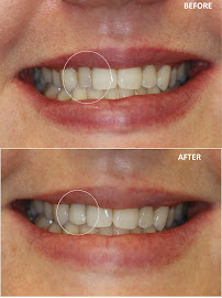 Melbourne Smile Clinic