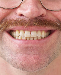 Sonreir Teeth Whitening