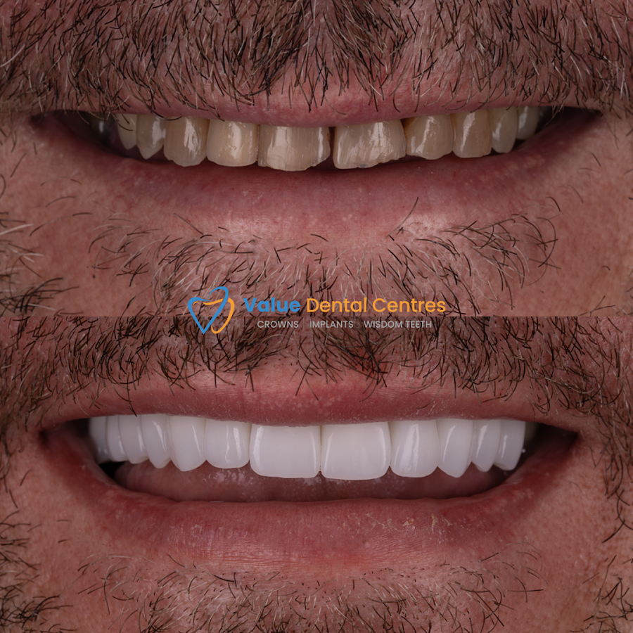 Value Dental Centres Melbourne