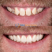 Value Dental Centres Melbourne