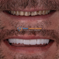 Value Dental Centres Melbourne in Melbourne