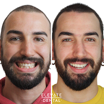 Elevate Dental