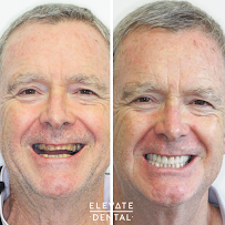 Elevate Dental