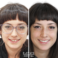 Elevate Dental