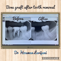 Instant Cosmetic & Implant Dental Surgery