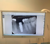 Instant Cosmetic & Implant Dental Surgery in Melbourne