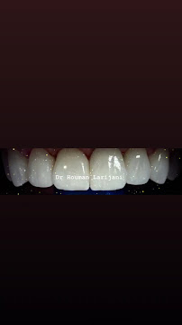 Instant Cosmetic & Implant Dental Surgery