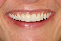 Melbourne East Prosthodontics