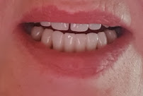 Glenferrie Dental Hawthorn - Dental Implants and All on 4 Cosmetic Dentist