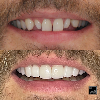 Todays Dental Edgecliff - Dr. Mathew Ramzy | Sydney Boutique Dental Studio