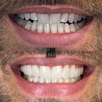 Todays Dental Edgecliff - Dr. Mathew Ramzy | Sydney Boutique Dental Studio