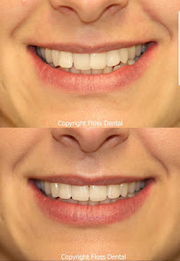 Floss Dental Broadway Dentist