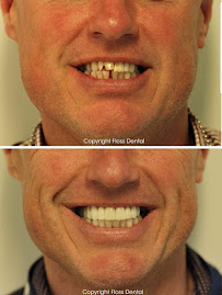 Floss Dental Broadway Dentist