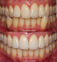 Floss Dental Broadway Dentist