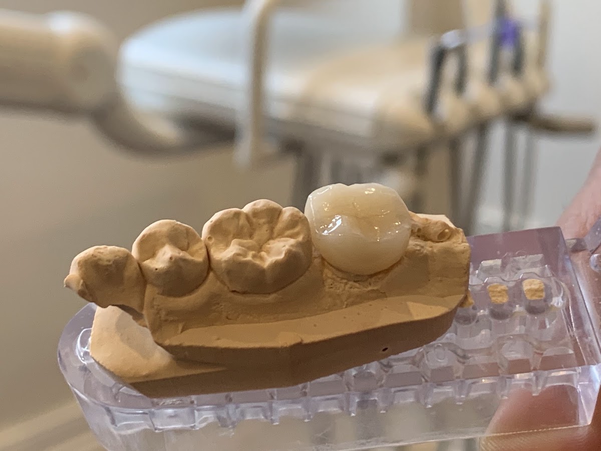 Laser Root Canal Sydney