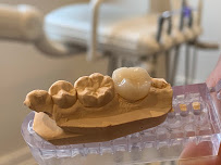 Laser Root Canal Sydney in Sydney