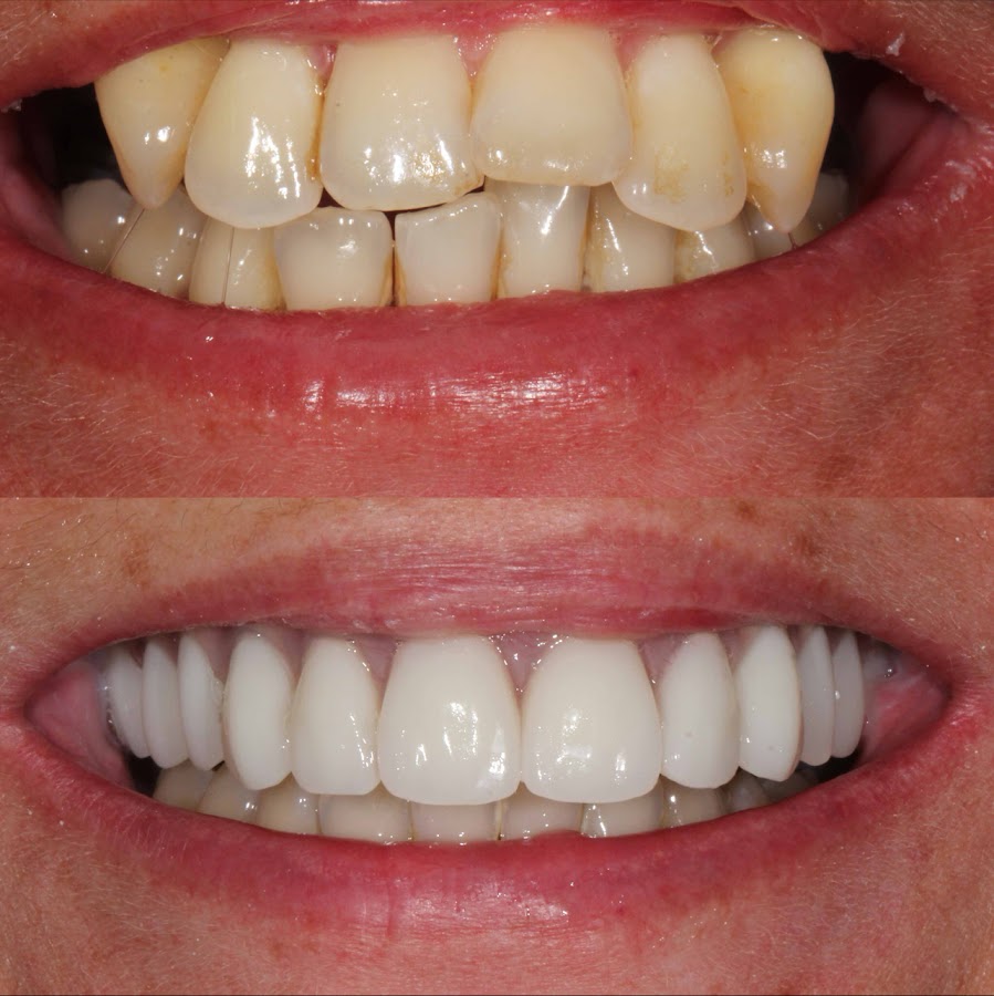 Lumiere Dental and Implants Centre