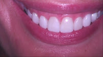 Lumiere Dental and Implants Centre