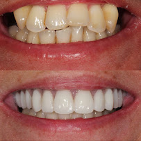 Lumiere Dental and Implants Centre in Sydney