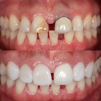 Lumiere Dental and Implants Centre