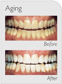 Eco Dental