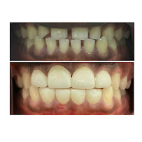 Chatswood Smiles | Local Family Dentist - Crowns - Implants - Invisalign - Emergency Dentist - Cosmetic Dentist