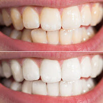 Dental On King